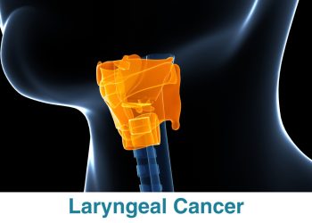 Studi: AI Deteksi Kanker Laring dari Suaramu