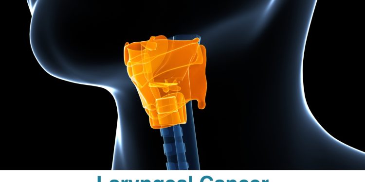 Studi: AI Deteksi Kanker Laring dari Suaramu