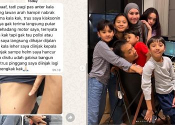 Kronologi Karyawan Zaskia Adya Mecca Dipukuli dan Diinjak Aparat, Anak Hanung Bramantyo Menggigil